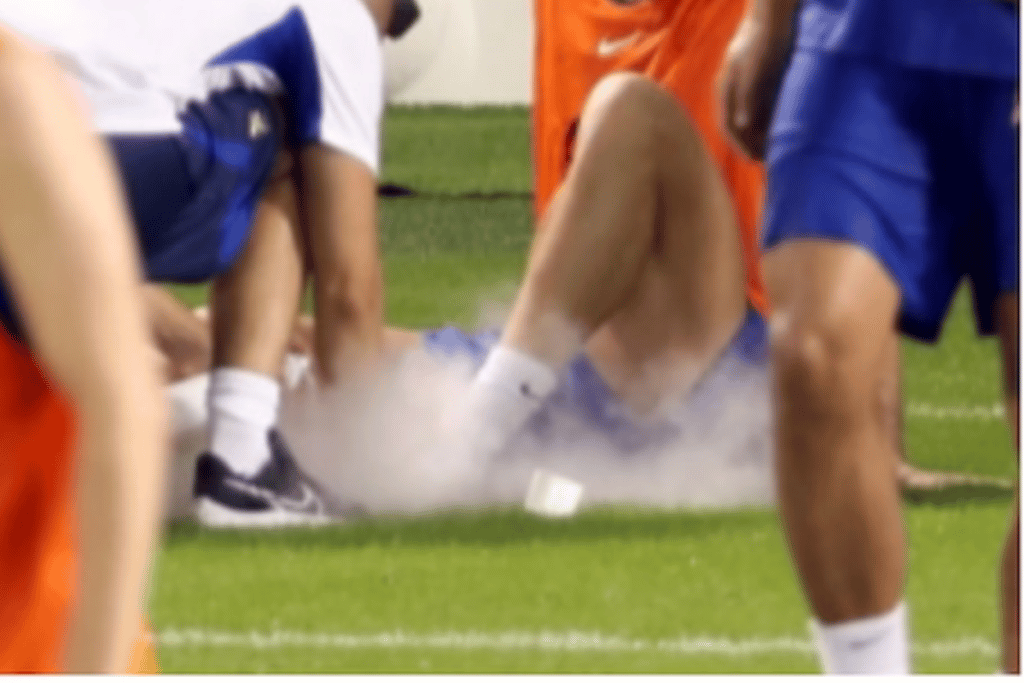 Campe&atilde;o do Mundo vira preocupa&ccedil;&atilde;o para a Fran&ccedil;a