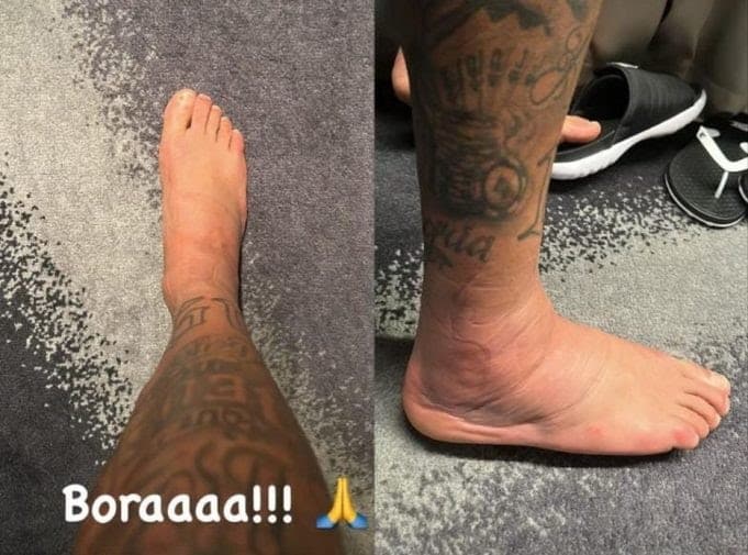 Incha&ccedil;o no tornozelo melhora e craque pode refor&ccedil;ar o Brasil ainda na fase de grupos